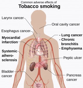 Adverse effects of tobacco smoking