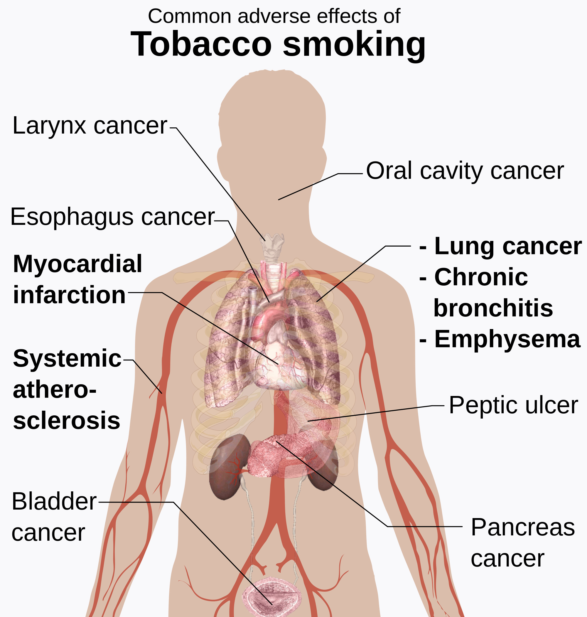 Adverse effects of tobacco smoking - Quit Now